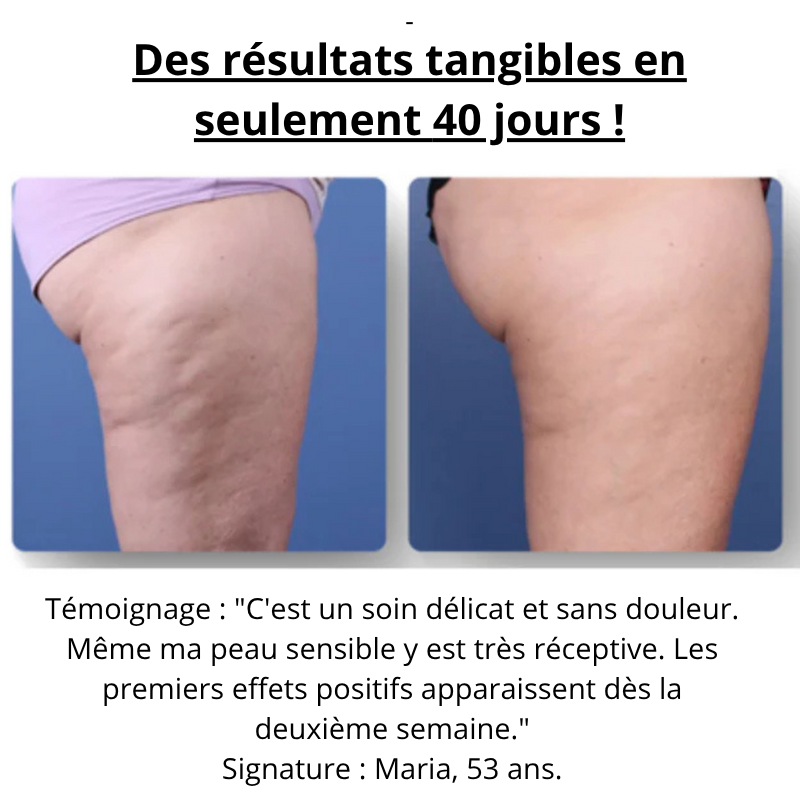 Emera SculptPro 2025